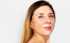 Melasma na Gravidez: 7 Dicas Comprovadas para Prevenir de Verdade