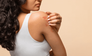 9 Doenças que Causam Manchas na Pele (e Quando se Preocupar)