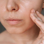 Skincare para pele oleosa