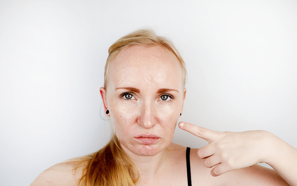 Skincare para pele oleosa